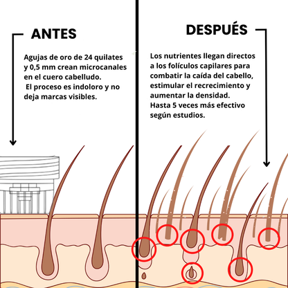 Rewaine™ Sérum de Recrecimiento Capilar