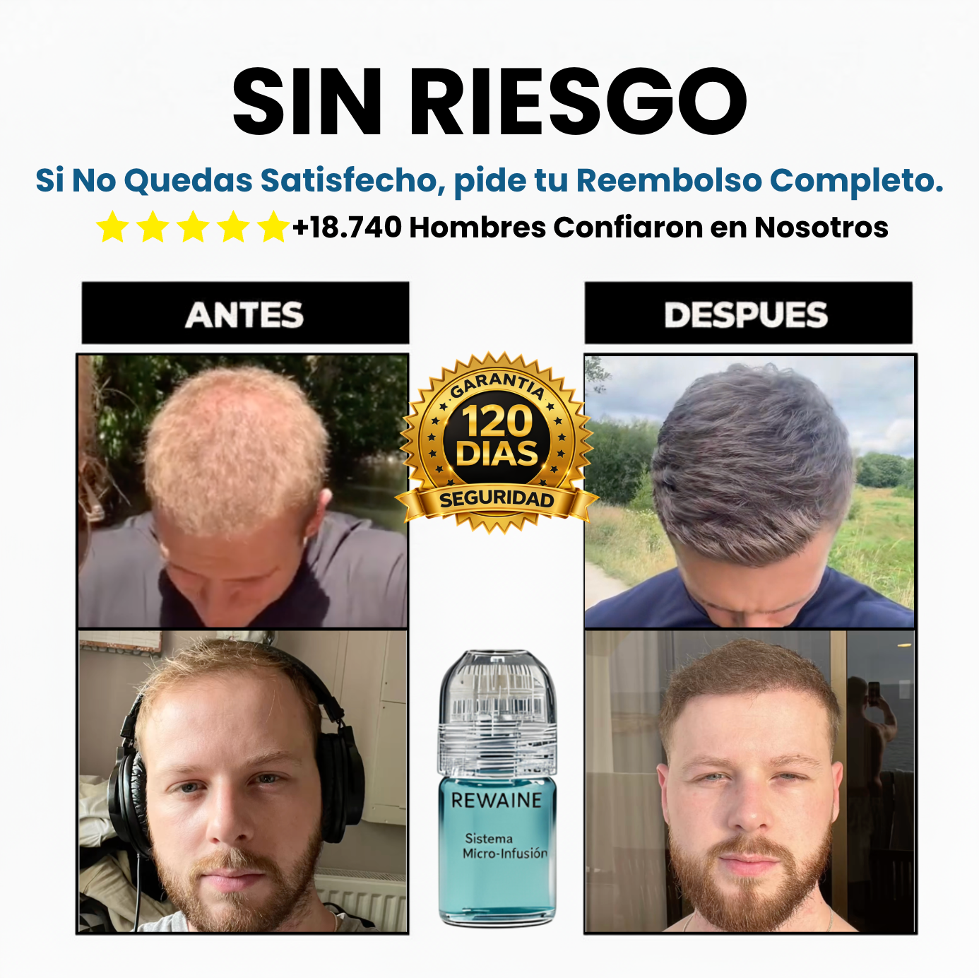 El Recrecimiento Capilar más Potente del Mercado