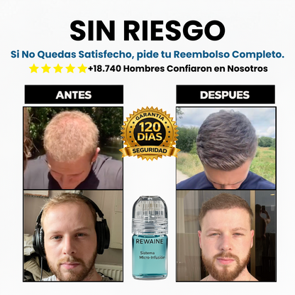 El Recrecimiento Capilar más Potente del Mercado
