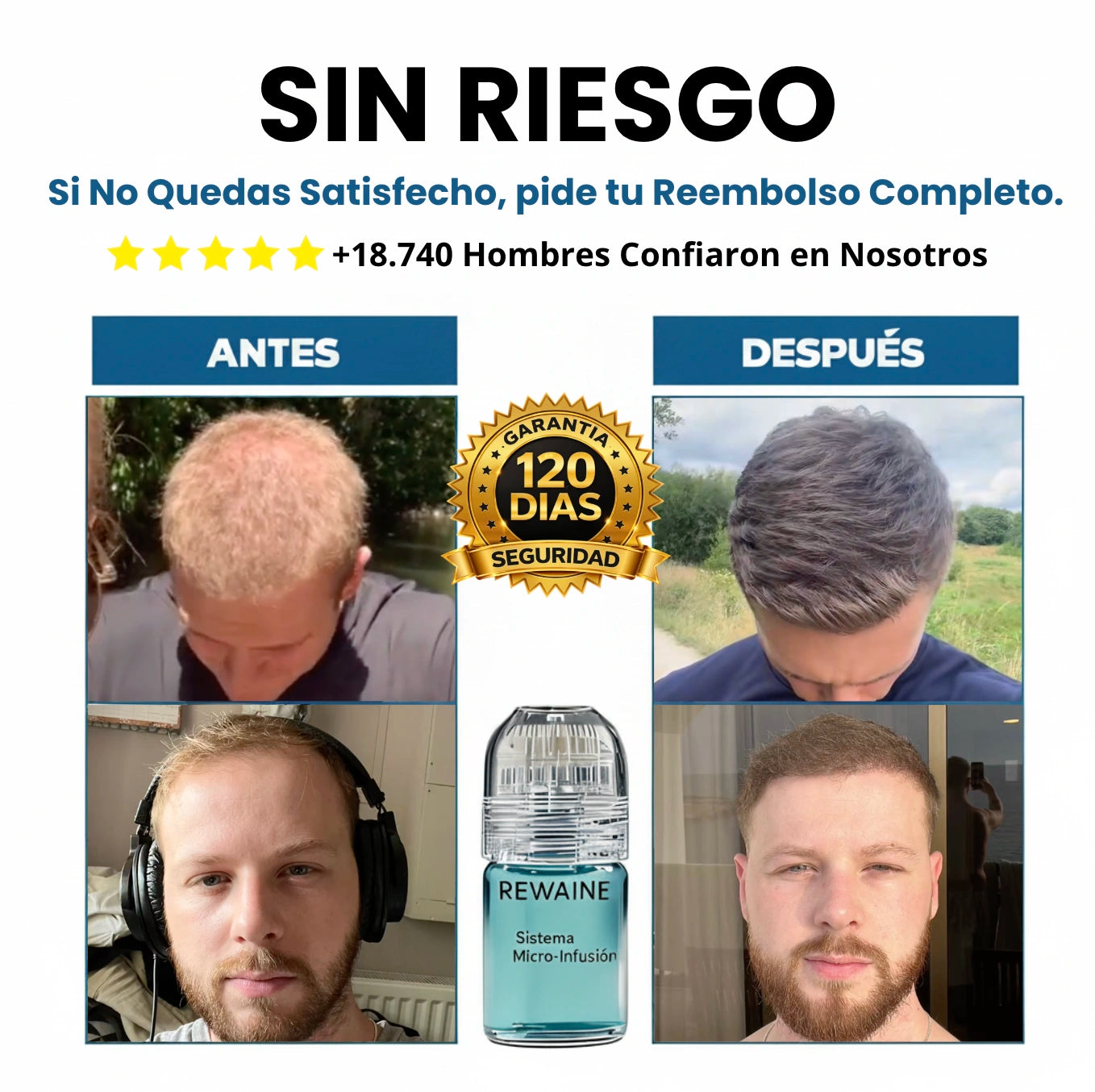 El Sistema de Infusión de Péptidos para el Recrecimiento Capilar