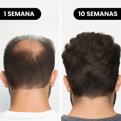 Rewaine™ Sérum de Recrecimiento Capilar